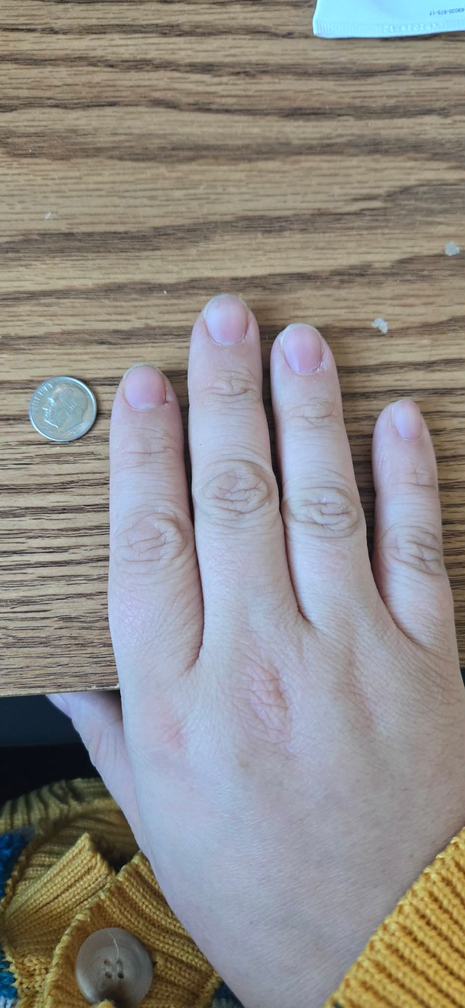 Example of the coin method — four fingers placed flat on a surface next to a dime for size reference